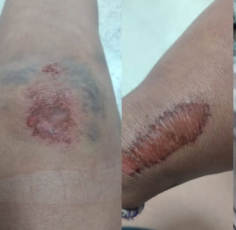 «Nadie se hace cargo»: una joven sufrió un grave accidente en Uber Moto tras chocar contra un caballo en la Ruta 25 de Mayo